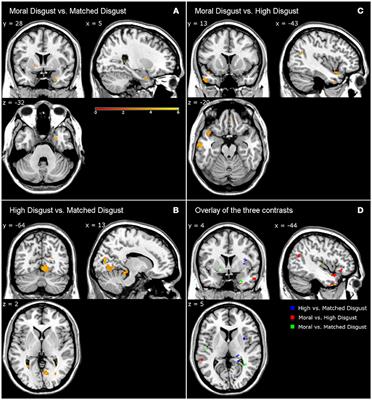 Moral Violations and the Experience of Disgust and Anger